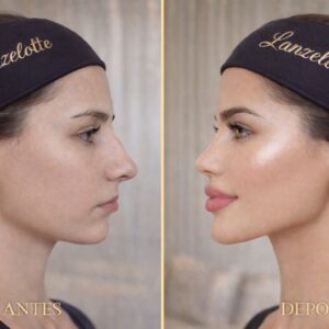 R$ 5,00 Para concorrer. GARANTA JÁ